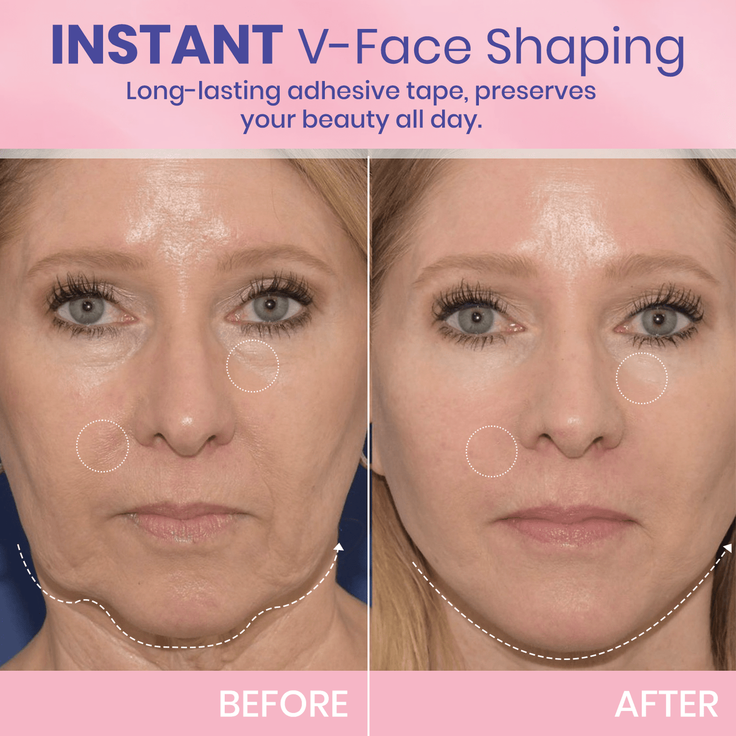 V-Face 👑 Invisible lifting tape