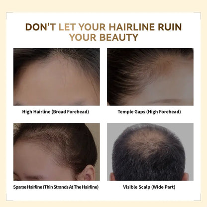 Springorigin Hairline Powder – Root Touch Up, Gray Coverage & Hairline Concealer, 48H Stain-Proof, for Women & Men