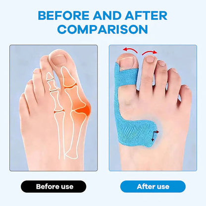 Bunion Correction Muscle Tape🦶 The Easier Way To Support & Protect Your Bunion Every Day