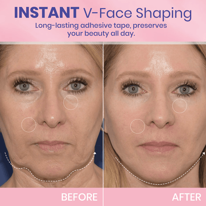 V-Face 👑 Invisible lifting tape
